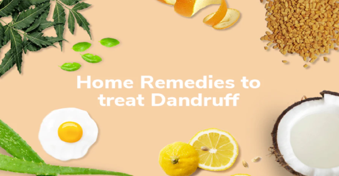 Home Remedies for Dandruff Treatment