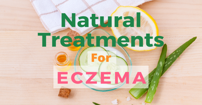 Home Remedies for Severe Eczema