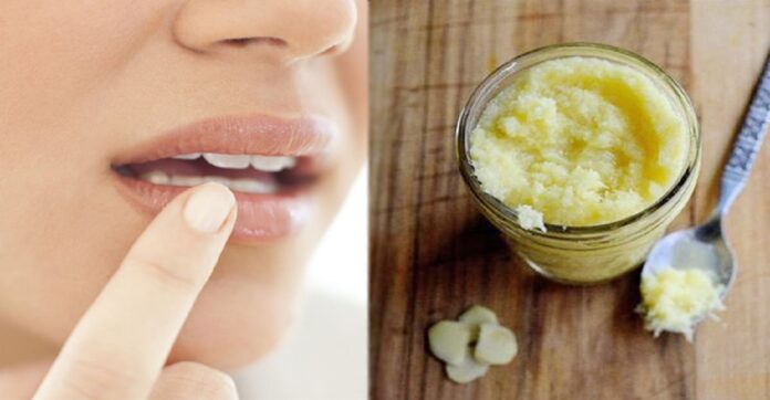 Home Remedies to remove white spots on lips